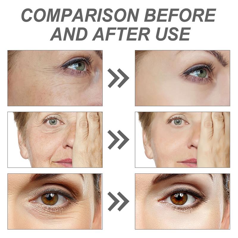 Сыворотка для лица с ретинолом – обзор и цена The Ordinary Serum Hyaluronic Acid